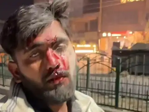 बेगुनाह युवक पर जानलेवा हमला,