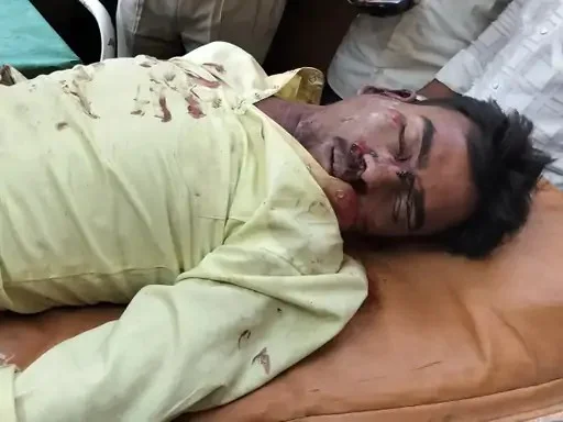 रसूलाबाद मार्ग पर भीषण सड़क हादसा; अनियंत्रित होकर बिजली के पोल से टकराई तेज रफ्तार बाइक, जीजा-साले लहूलुहान; एक की हालत नाजुक